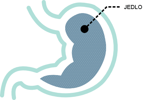 Image showing effect without glukomanan